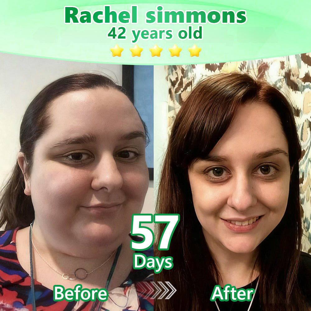 𝐑𝐞𝐜𝐨𝐦𝐦𝐞𝐧𝐝𝐞𝐝 𝐛𝐲 𝐒𝐨𝐮𝐭𝐡 𝐀𝐟𝐫𝐢𝐜𝐚𝐧 𝐃𝐨𝐜𝐭𝐨𝐫𝐬｜𝐋𝐎𝐓𝐌𝐀𝐘®👨‍⚕️𝐆𝐋𝐏-𝟏 𝐎𝐫𝐚𝐥 𝐖𝐞𝐢𝐠𝐡𝐭 𝐋𝐨𝐬𝐬 𝐒𝐨𝐥𝐮𝐭𝐢𝐨𝐧🍀(𝐎𝐧𝐞 𝐯𝐢𝐚𝐥 𝐞𝐯𝐞𝐫𝐲 𝐭𝐰𝐨 𝐝𝐚𝐲𝐬, 𝐯𝐢𝐬𝐢𝐛𝐥𝐞 𝐫𝐞𝐬𝐮𝐥𝐭𝐬 𝐢𝐧 𝟕 𝐝𝐚𝐲𝐬) 𝐒𝐮𝐢𝐭𝐚𝐛𝐥𝐞 𝐟𝐨𝐫: 𝐨𝐛𝐞𝐬𝐢𝐭𝐲, 𝐜𝐚𝐫𝐝𝐢𝐨𝐯𝐚𝐬𝐜𝐮𝐥𝐚𝐫 𝐡𝐞𝐚𝐥𝐭𝐡 𝐢𝐬𝐬𝐮𝐞𝐬, 𝐝𝐢𝐚𝐛𝐞𝐭𝐞𝐬, 𝐬𝐥𝐞𝐞𝐩 𝐚𝐩𝐧𝐞𝐚, 𝐠𝐮𝐭 𝐡𝐞𝐚𝐥𝐭𝐡, 𝐣𝐨𝐢𝐧𝐭 𝐩𝐫𝐨𝐛𝐥𝐞𝐦𝐬, 𝐚𝐧𝐝 𝐦𝐨𝐫𝐞